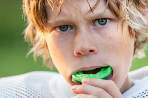 Protective Mouth Guards for Athletes