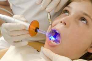 Technological Advances Offer More Options for Dental Fillings