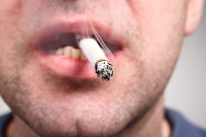 Smoking Damages Teeth