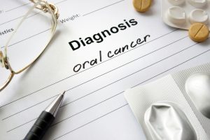 Oral Cancer